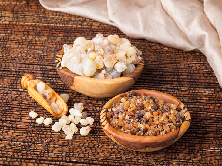 Osteoarthritis and therapeutic potential of Boswellia serrata in inflammatory joint degeneration
